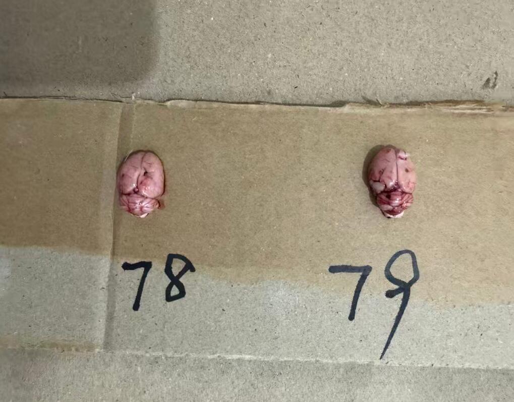 SD大鼠脑瘤模型-脑组织4