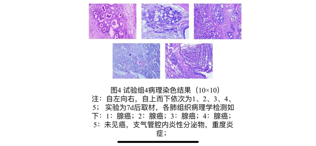 实验兔肺肿瘤模型病理图片2
